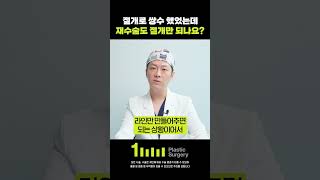 대리수술 없습니다. 이진호성형외과의원#shorts
