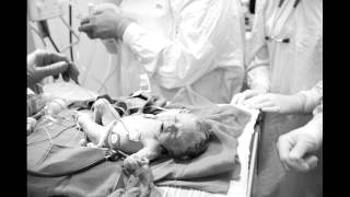 The Birth of Angelina Rose, a Trisomy 18 miracle