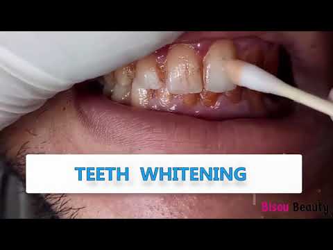 Teeth whitening super clean Labena Dents Blanchissment Maroc Morocco