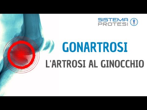 Che è vitamine migliori per giunti Rafforzare i muscoli della schiena di osteocondrosi ed ernia