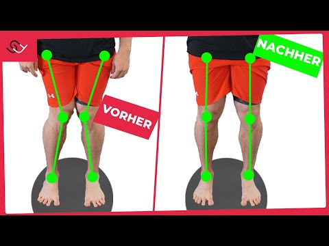 X Beine loswerden - Mit diesen 2 einfachen Übungen