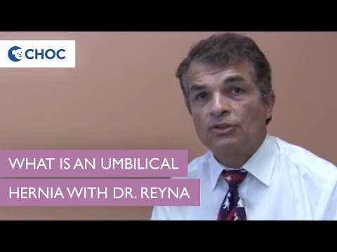 What is an Umbilical Hernia? Explained by Dr. Reyna | Pediatric Surgery | CHOC