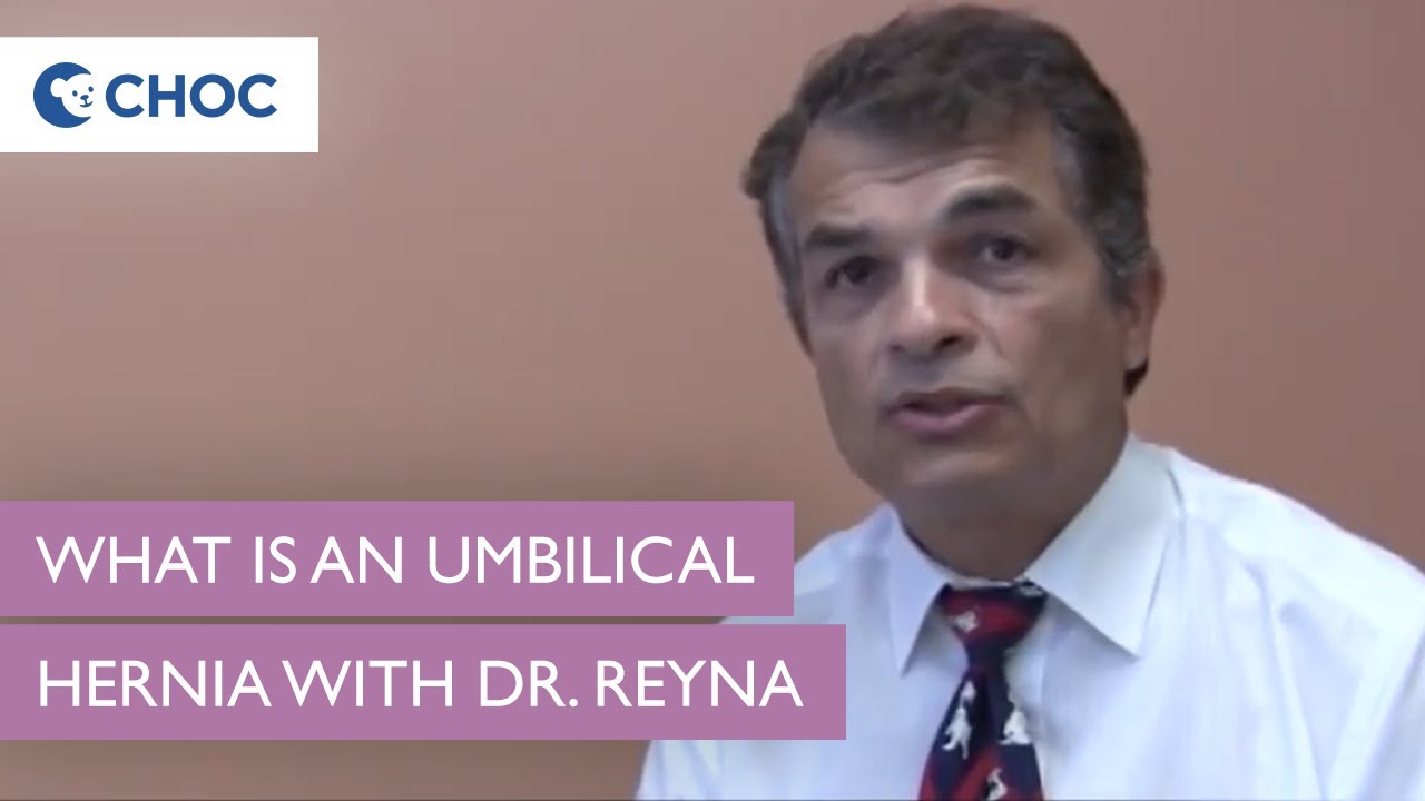 What is an Umbilical Hernia Explained by Dr. Reyna | Pediatric Surgery | CHOC