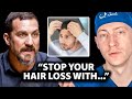 How to Stop Hair Loss Before it's Too Late | Surgeon Reacts to @hubermanlab