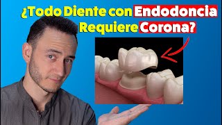 Si tienes Endodoncias, necesitas Corona en esos dientes. ¿Mito o realidad