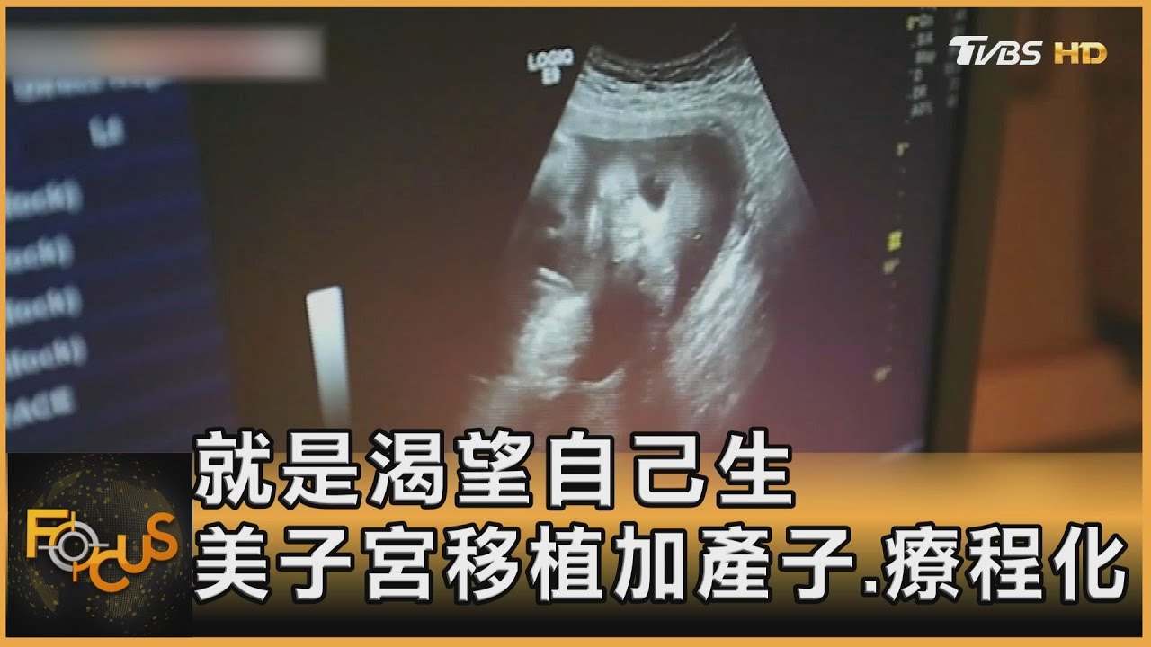 就是渴望自己生 美子宮移植加產子.療程化