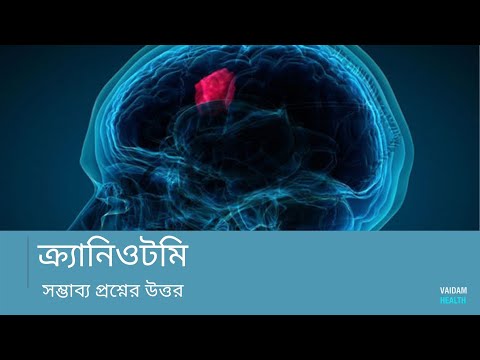 ক্র্যানিওটোমি- প্রায়শই জিজ্ঞাসিত প্রশ্ন