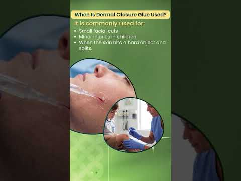 Skin Glue for Facial Cut - Mudappa Video skin glue