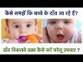 8 Teething Symptoms in Babies & 4 Home Remedies to Sooth Teething(Hindi)||