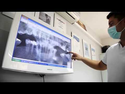 download lagu mp3 mp4 Cheap Dental Implants Croatia, download lagu Cheap Dental Implants Croatia gratis, unduh video klip Cheap Dental Implants Croatia