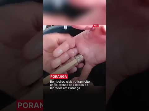 Bombeiros retiram oito anéis presos nos dedos de homem em Poranga #shorts #Resgate #Poranga
