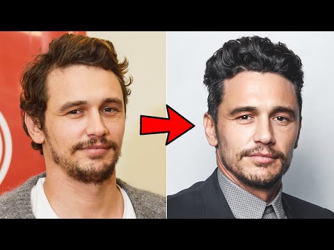 How James Franco Reversed His Hair Loss
