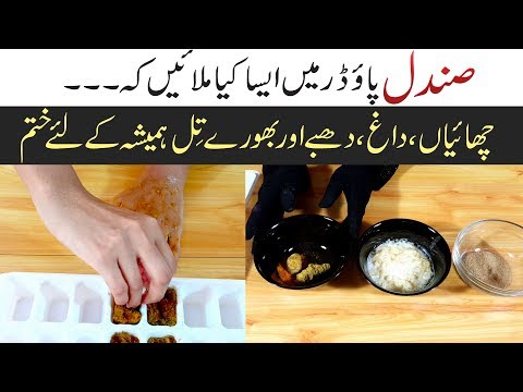 Freckles, Pigmentation & Brown Spots Homemade Treatment with Home Remedies Urdu Hindi