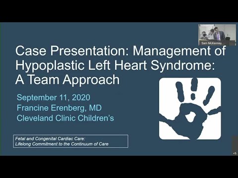 Case Presentation - Management of Hypoplastic Left Heart Syndrome: A Team Approach