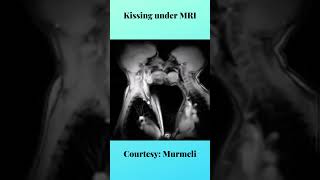 French kissing captured under MRI