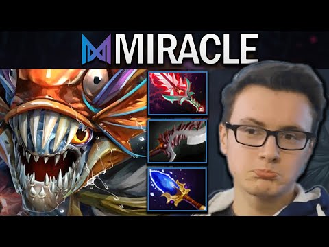 Slark Dota 2 Gameplay Miracle with 21 Kills - Aghanims