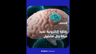 رجل مشلول يستعيد حركته بعد زرع رقاقة إلكترونية في دماغه thumbnail