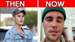 The Truth About JUSTIN BIEBERS FACE!