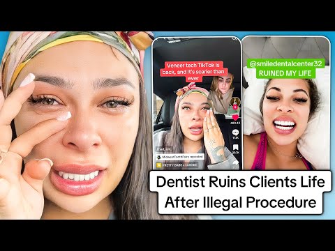 TikTok Dentist Ruins Clients Life With Illegal Procedure