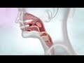 What is Throat Cancer? | Cancer Research UK