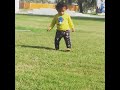 14 Month Old Bow Legged Baby Walking