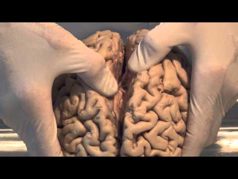 Neuroanatomia-mózg 