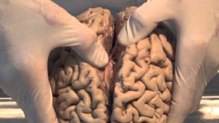 Introduction: Neuroanatomy Video Lab - Brain Disse