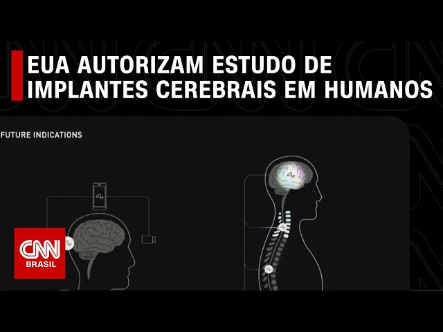 EUA autorizam estudo de implantes cerebrais em humanos | CNN PRIME TIME
