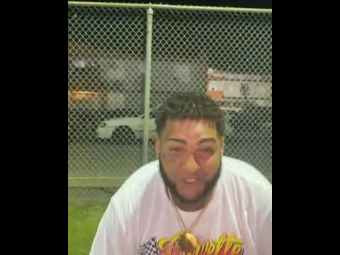 @guccifiel 🆚️ @tutupr_ ⚰🔥🔥