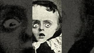 severed heads goodbye tonsils