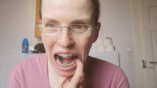 #27: 13 Monate Controlled Arch