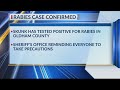 Vega reports another skunk with rabies
