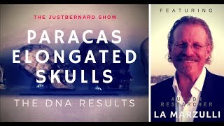 DNA of Paracas Elongated Skulls - LA Marzulli on TJBS