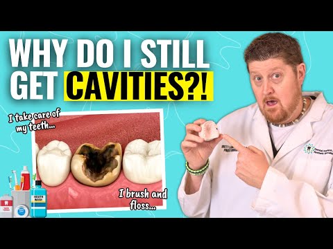 Why You’re Getting Cavities Even with Perfect Dental Care