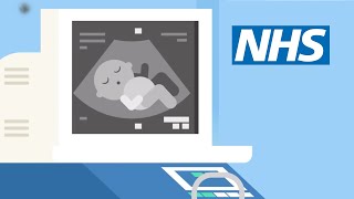 Screening tests for you and your baby | NHS