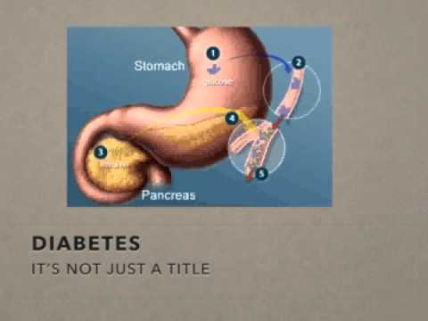 Video thumbnail for Sugar Management Part 1