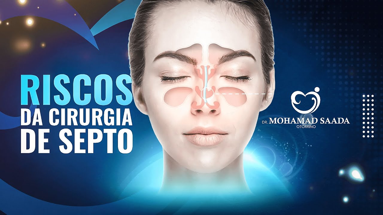 Desvendando a Cirurgia de Desvio de Septo: Riscos, Idade Ideal, Recuperação e MAIS!