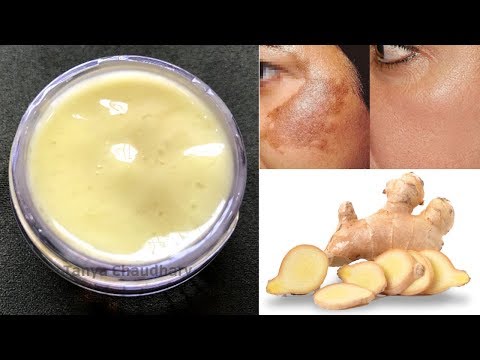 DIY Ginger Cream | Remove Pigmentation, Dark Spots & Acne Scars| Anti-Aging & Skin Lightening Cream Video