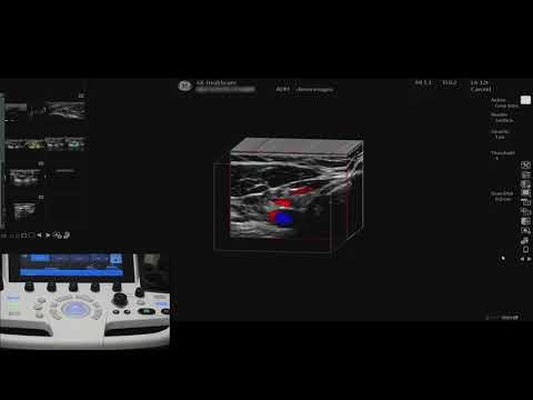LOGIQ P9 Tutorials: 3D Capabilities