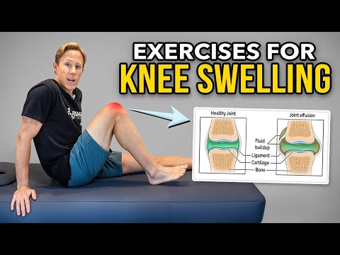 Anatomie & Behandlungswissen Videos – Interaktives Nachschlagewerk für Physio, Massage, Therapie 14 How to Get Rid of Knee Swelling