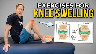 How to Get Rid of Knee Swelling