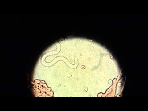 Heartworm Infection - Microfilaria Video