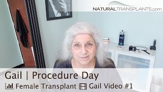 Female Hair Transplant Experts | Best Hair Restoration Clinic Jupiter, FL for Men and Women (Gail)