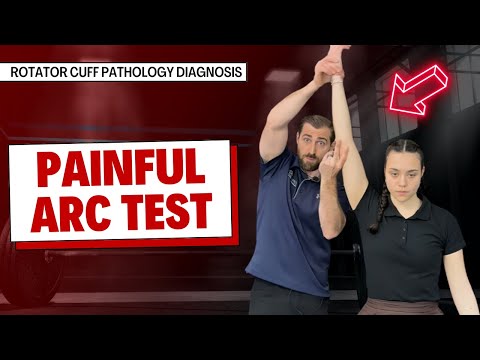 Painful Arc Test for Rotator Cuff Pain Assessment