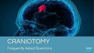 Craniotomy - Frequently Asked Questions