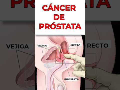 3 Lecciones del cáncer próstata