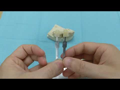 So sieht die Zahnfarbe A2 aus