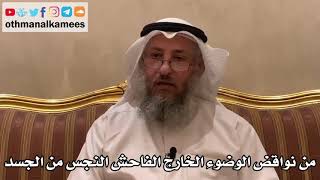 382 - من نواقض الوضوء الخارج الفاحش النجس من الجسد - عثمان الخميس