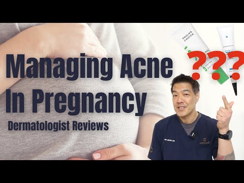 Managing Acne in Pregnancy- Safe & Effective