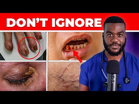 15 weird signs that show you're having LIVER DAMAGE